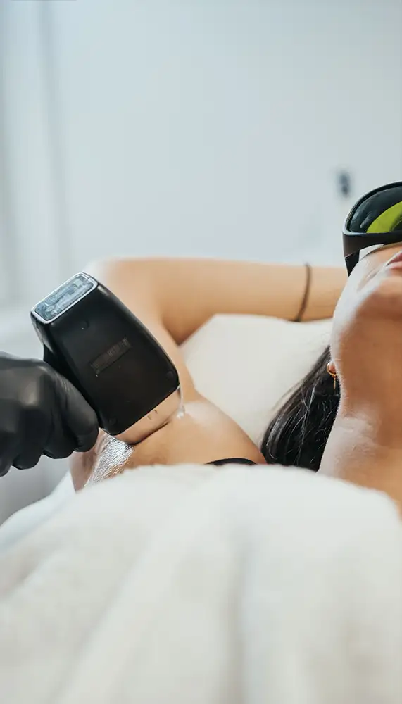Épilation laser